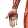 Wrist & Hand - Myofascial Pain Syndrome (muscle pain)